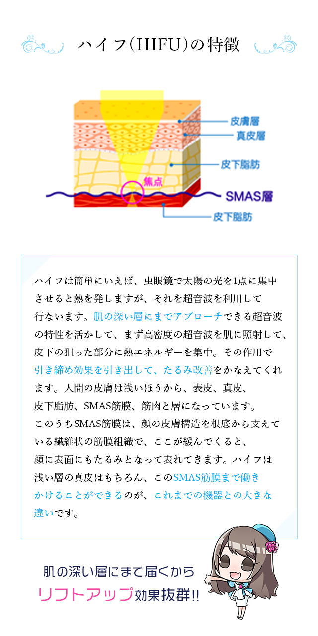 HIFUの特徴