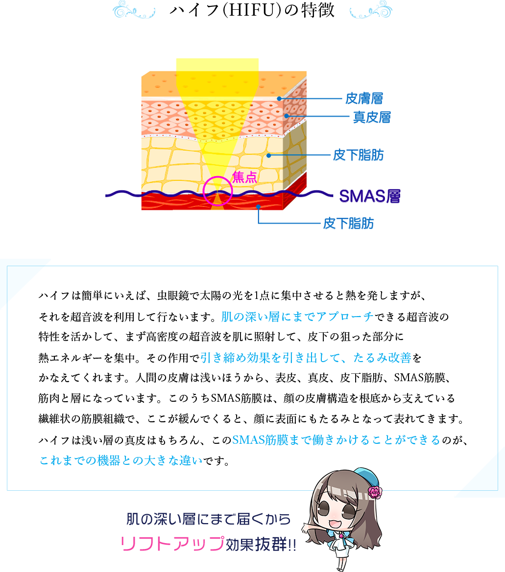 HIFUの特徴
